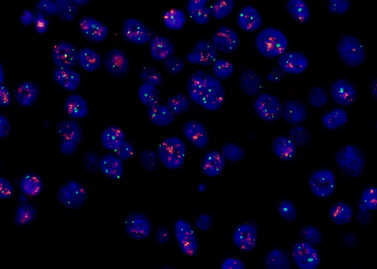 MSHOT荧光原位杂交技术(FISH)的应用